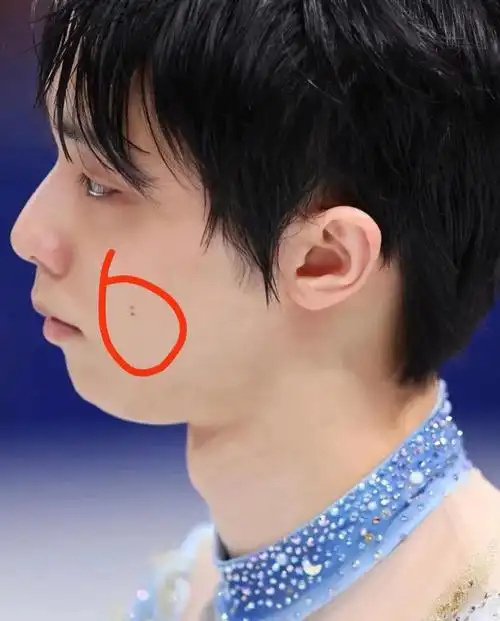 来解读这个痣的含义水厄:这个特别明显了,水通冰,冰上受伤的关系口舌