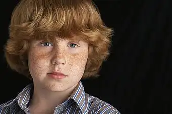 满脸麻子的金发男孩图片下载