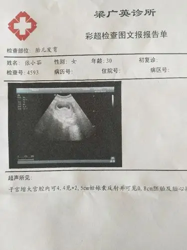 45天孕囊和3个月的彩超 帮忙看看男孩女孩