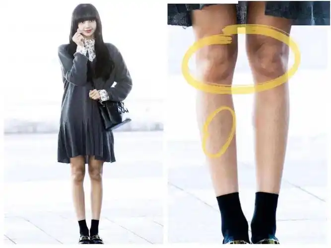 关掉10级美颜后不敢相信这是lisa的腿