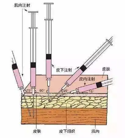 猪场常用5种注射方式