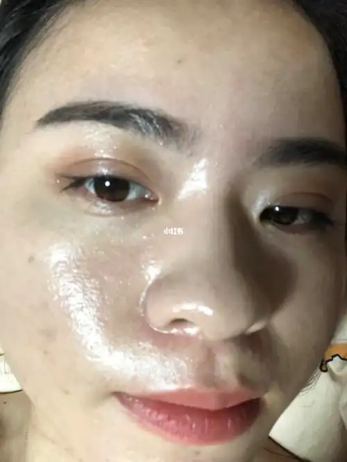 大油皮夏天都用什么_夏天去哪玩_油痘肌_美妆_护肤_护肤其他