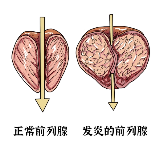 梦见被子被水浸湿,梦见被子被水弄湿了(生理性和病理性遗精有何区别)