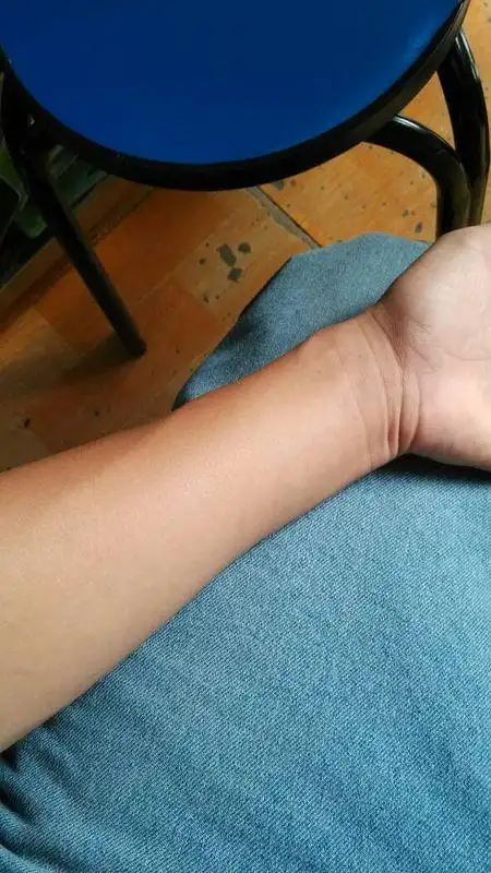 为什么我的手臂那么细