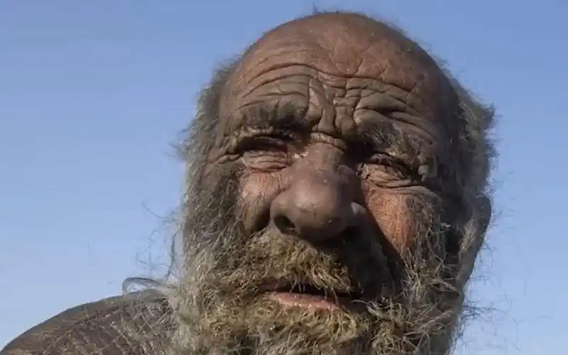 "全球最脏的人"60多年没洗澡:被带去洗澡,数月后病亡