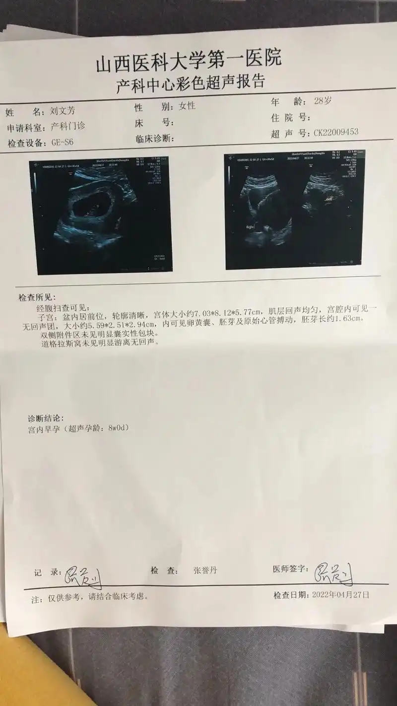 我的宝贝准备退vip房啦.熬过了孕早期的保胎,每天三大碗的中 - 抖音