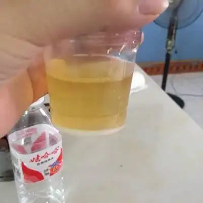 听说用晨尿加上小苏打可以测男女,大家帮我看看这是男还是女,谢谢大家