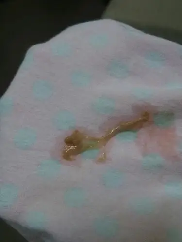 羊水会流几滴的吗?就是不是很多有没有这个情况?