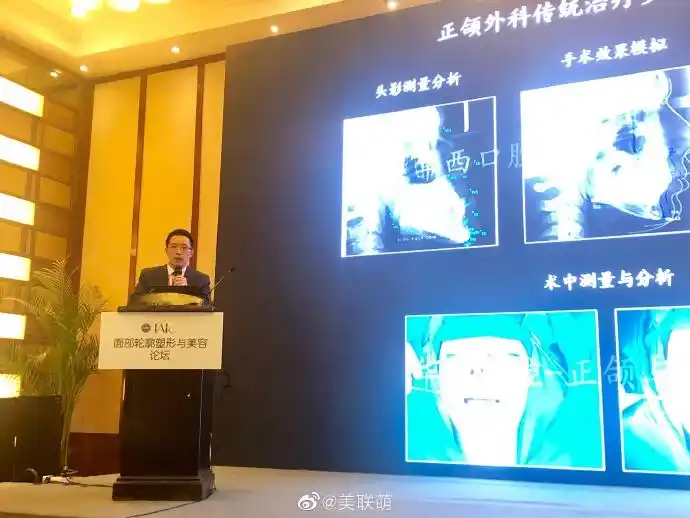 华西正颌-祝颂松教授,发表数字化技术在牙颌面畸形中的应用演讲.
