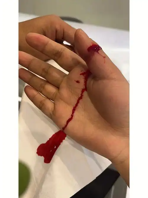 [请友好r]同行有遇到过吗?