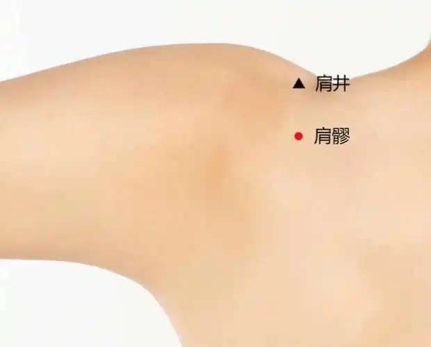 负压拔罐器治疗肩周炎