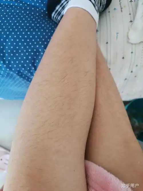 女生有腿毛会很自卑吗