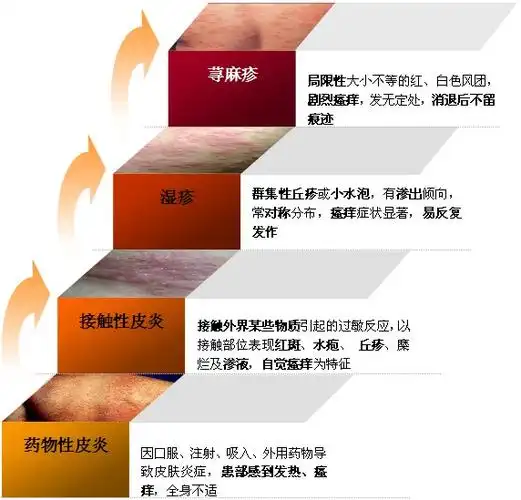 专家解析 破解红疙瘩瘙痒之谜_重庆治皮肤病医院