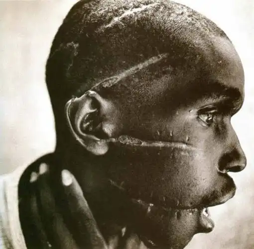 头部被砍的胡图族青年.