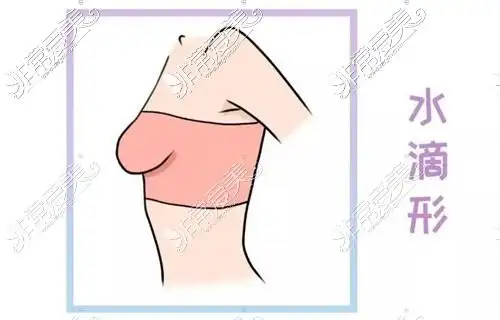 胸型水滴型和下垂型区别:特点,形态,哪个好看都在这儿了