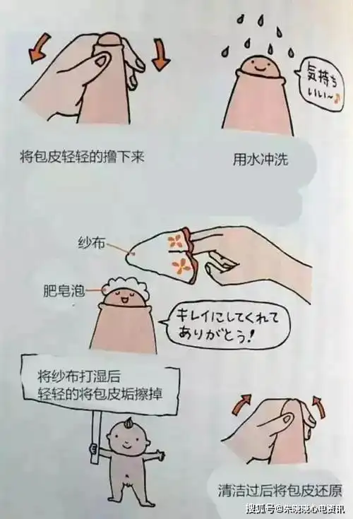 家长在男孩刚出生,第一眼看到小鸡鸡时,就要观察包皮是否正常.