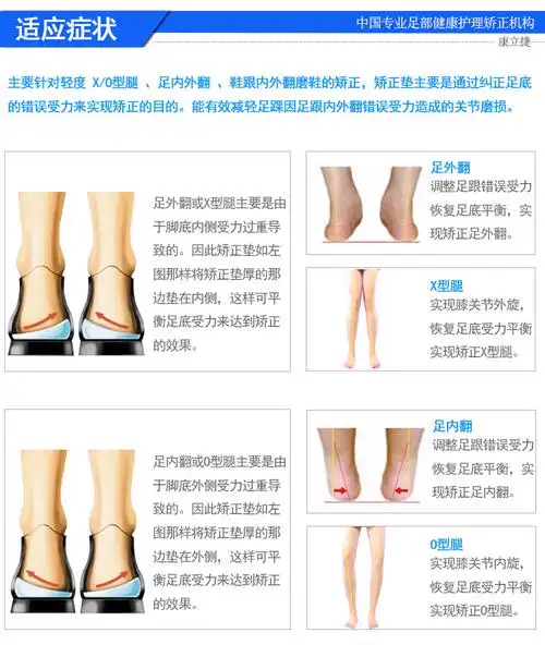 6765矫正垫京选好货后跟变形足内外翻鞋垫膝内翻xo型腿矫正膝外翻