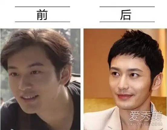 吴亦凡井柏然刘恺威 部分男明星整容到面瘫