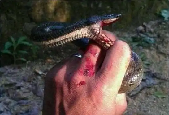 无毒小蛇咬的伤口图片大全