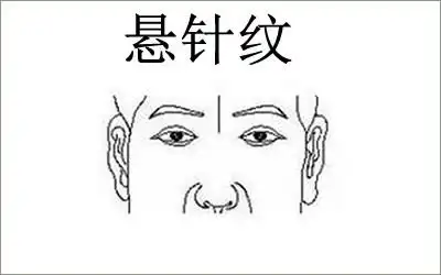 悬针纹怎么样怎样去掉悬针纹