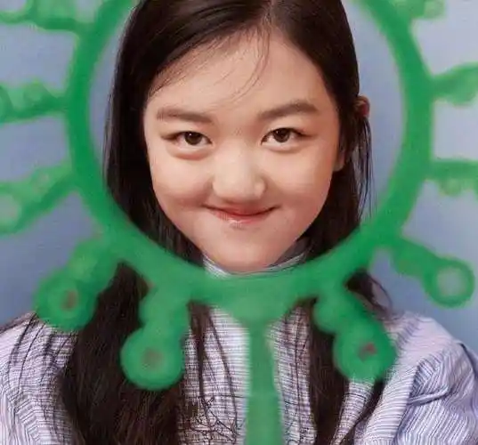 李嫣的嘴唇治好了吗 李嫣为什么会兔唇真相