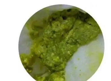 四,对脂肪消化不好(黄绿色,油亮)这样的绿便也不用特别护理,为了宝宝