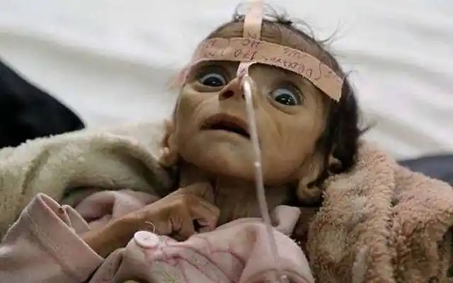 只有5个月大的宝宝被活活饿死,死前瘦骨嶙峋的模样让人心疼不已