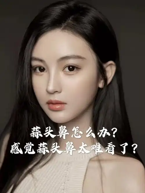 蒜头鼻子"是皮肤较厚,皮下组织量多,软骨支架肥厚且有向外膨隆之势.