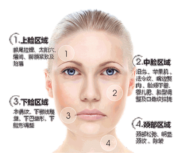 关于线雕的经典qa