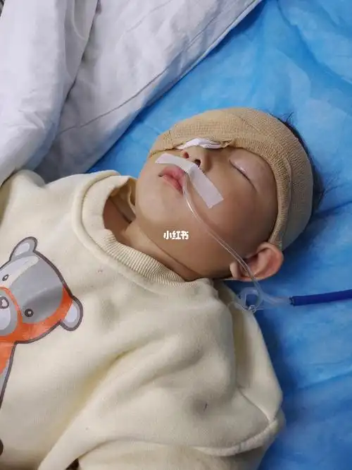手术顺利真的崩不住看的宝宝这样太难受了我的眼睛也哭肿了