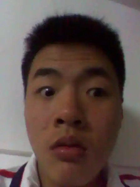 我的眼睛斜视怎么办