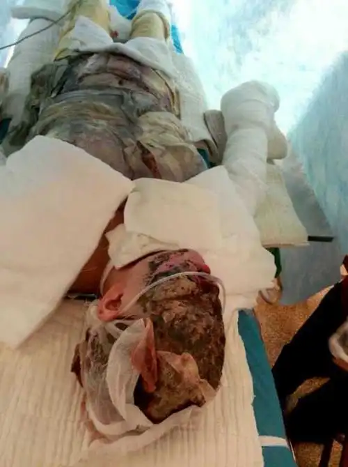 南充医保局电话 南充医保烧伤