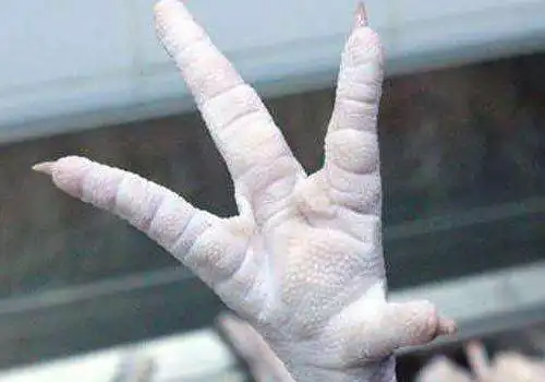 鸡爪手是什么病 怎么护理_漂亮女人街