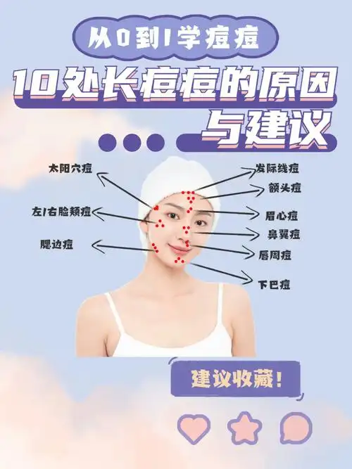 不同的长痘痘位置原因各不相同60对号入座60