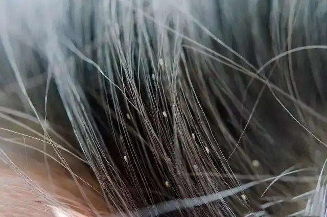 头虱一般只寄生于头部,产卵在发根,头虱的成长过程有卵,若虫和成虫