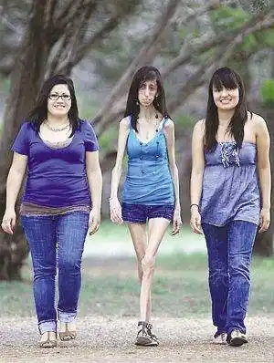 丑的女人:吉尼斯丑女与自封丑女对比图