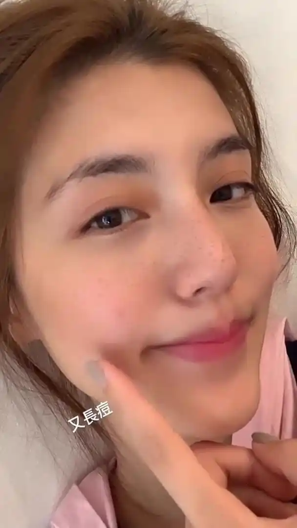 组图:又长痘!吴千语自揭"疮疤" 近镜自拍晒素颜现雀斑