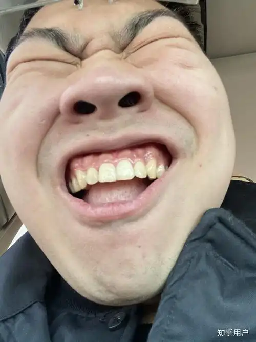 长得丑的男生到底有多惨? - 知乎