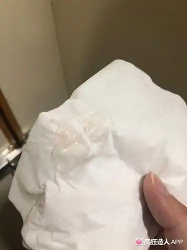 着床出血还是大姨妈?有没有跟我图差不多的?