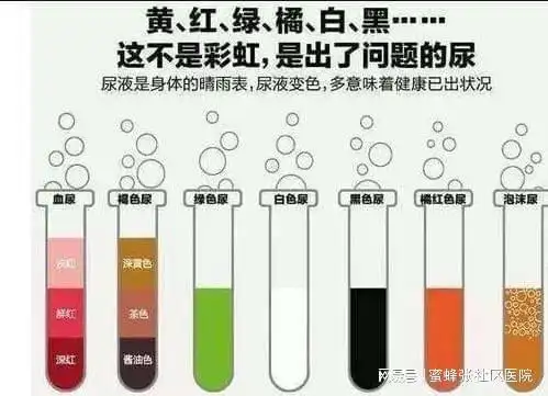 尿液颜色有12种,代表身体不同状况|肾脏|脱水|棕色|分泌物|色素_网易