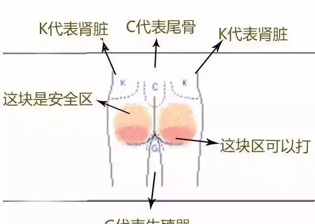 男孩不听话被亲爸打屁股致高烧孩子屁股千万别乱打小心打出事