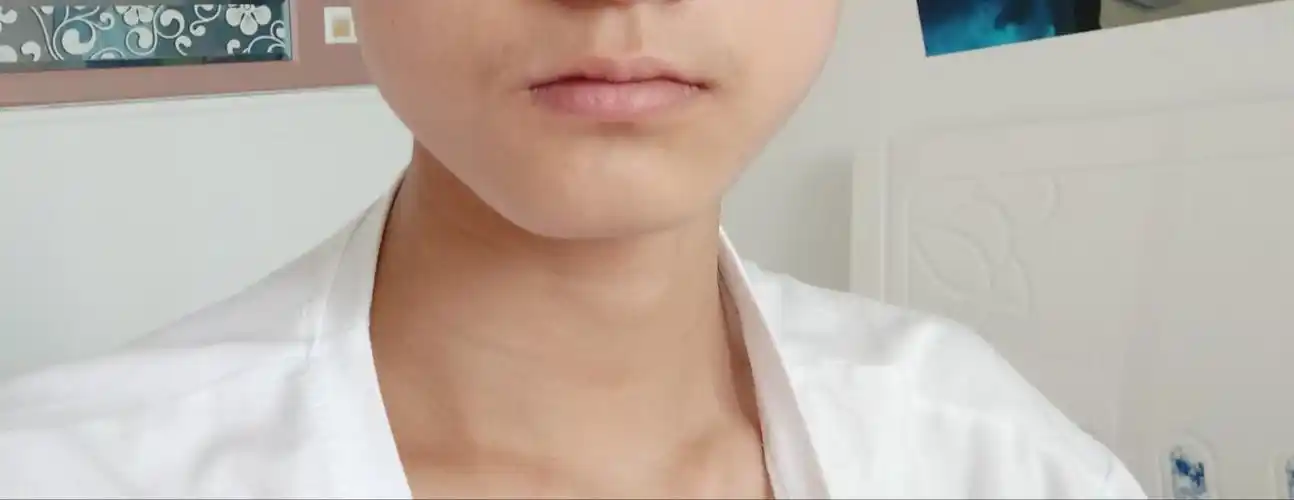 下巴歪斜这是为什么啊