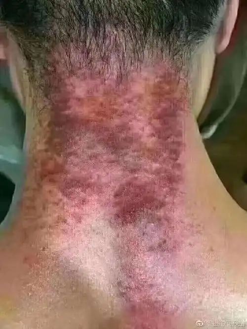 包调理,一次见效2,颈椎 胸椎 腰椎调理,调理后改变脊椎弯度,背部变薄1