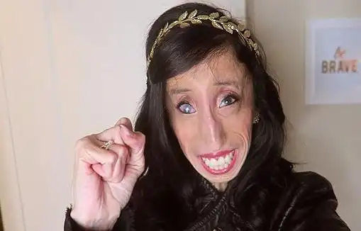 世界上最丑女人 利兹·维拉斯奎兹人虽丑却很励志