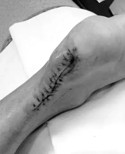 我是一个真实的刘翔