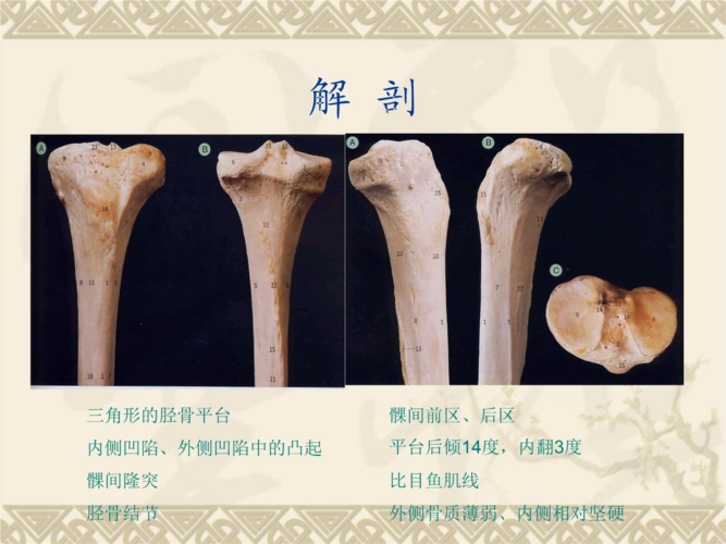 09胫骨平台骨折资料.ppt