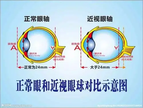 活动现场,医生分别从眼睛的构造,工作原理,近视远视的原因以及如何
