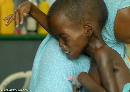 令人震惊的非洲饥荒儿童