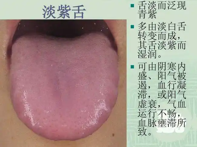 青紫舌(大承气汤,通脉四逆汤,血府逐瘀汤)即舌体局部或全部呈青紫色的