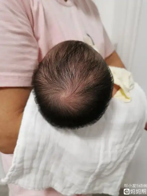 我看着是舟状头 菱形